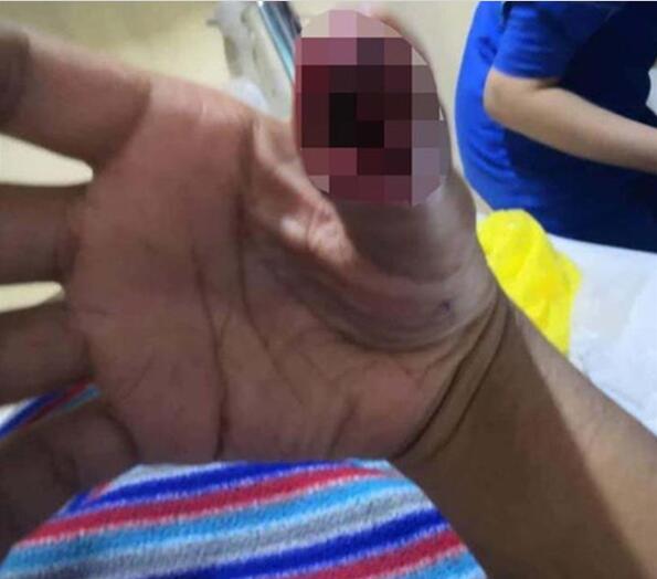 图：手机贴膜破会损伤手指